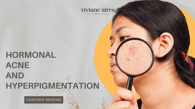 Understanding Hormonal Acne and Hyperpigmentation